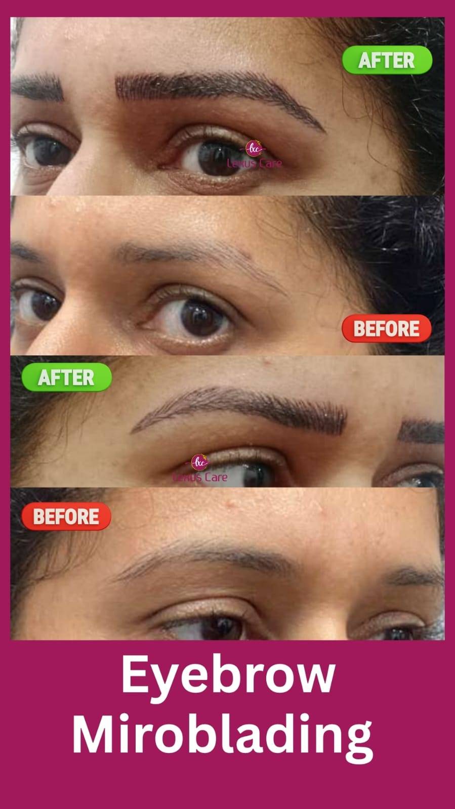Eyebrow Microblading