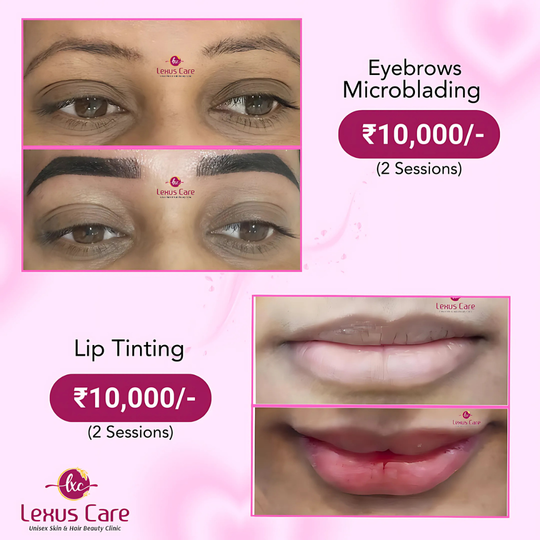 Lip Tinting / Lip Neutralization