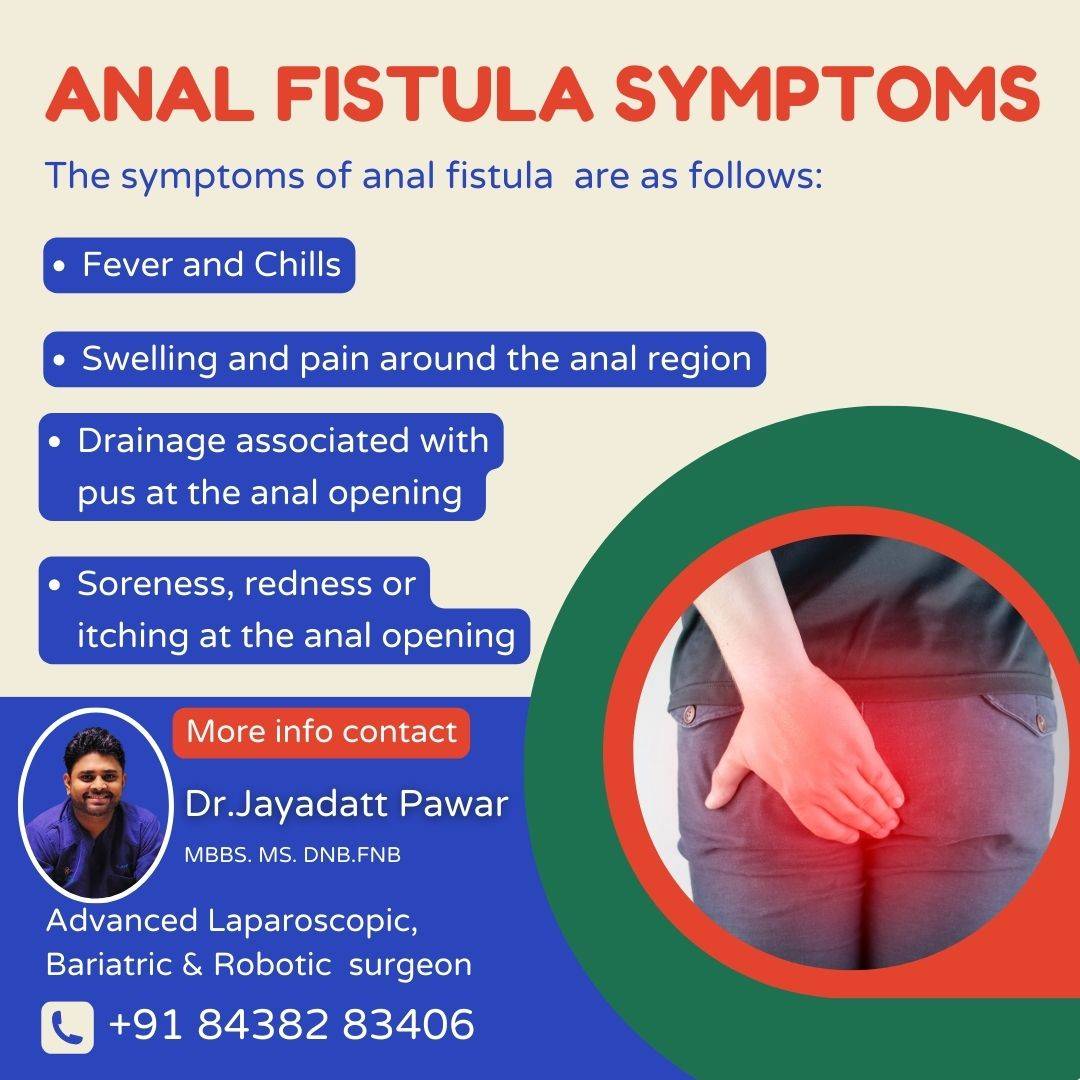 Dr. Jayadatt Pawar - Advanced Laparoscopic & Robotic Surgeon in Faridabad | Hernia, Colorectal & Bariatric Surgeon in Faridabad