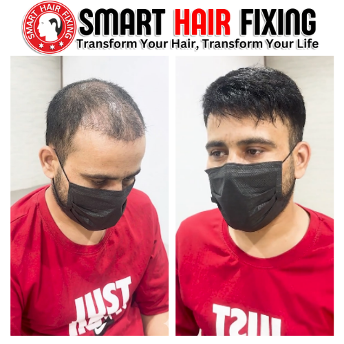 Smart Hair Fixing