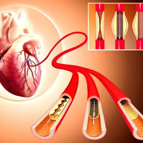drsravancardiologist