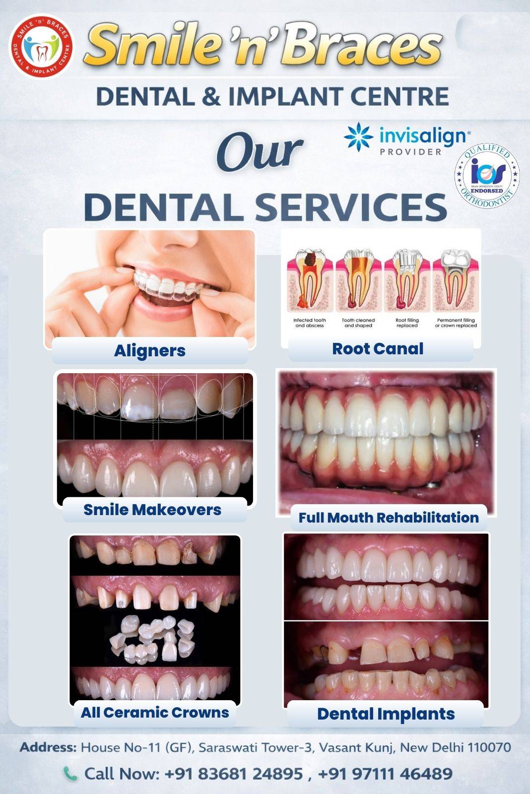 Smile 'n' Braces