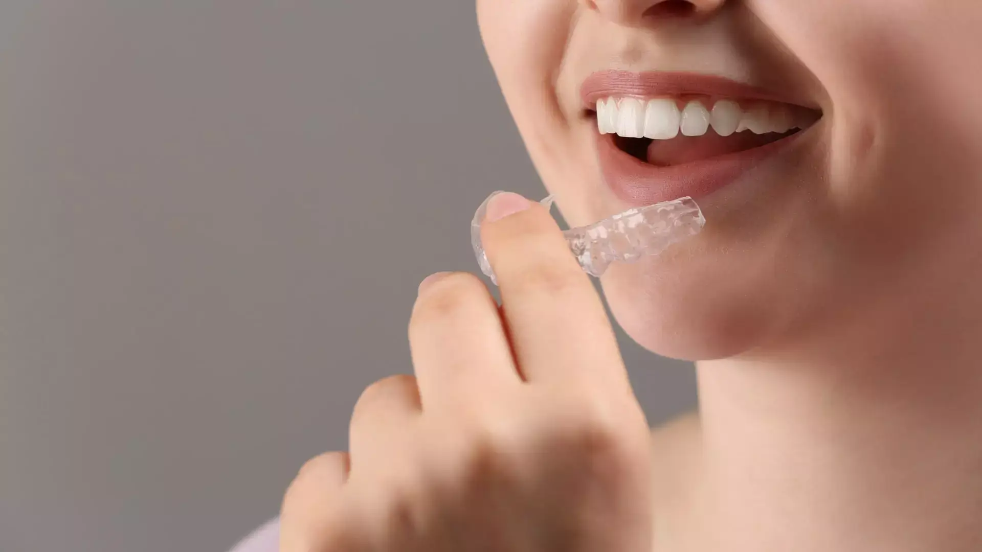 Kristelle Klear Aligners