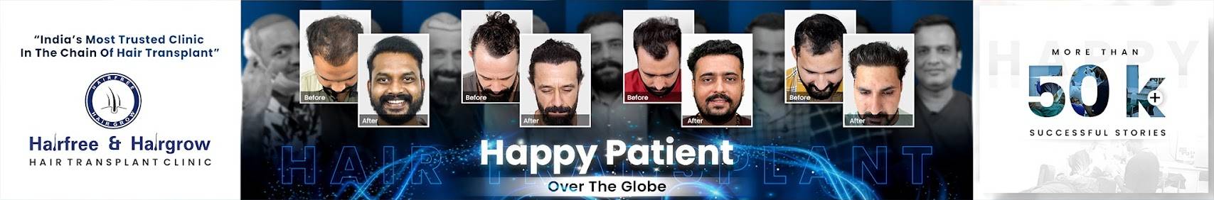 Hairfree & Hairgrow Hair Loss & Hair Transplant Clinic