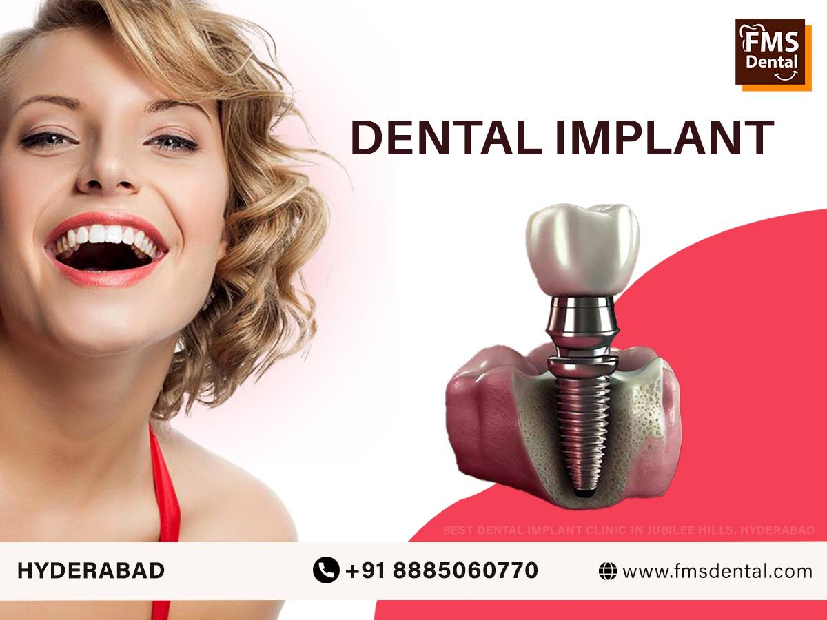 FMS International Dental Center - Advanced Dental Implant Clinic